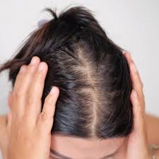 There are plenty of ways to spur growth and thicken hair naturally. Derms Agree This Is The Best Vitamin To Take Every Day For Thinning Hair Shefinds