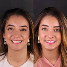 Dr. James Prado| Dentista