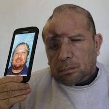 Man shot in head files claim against LAPD