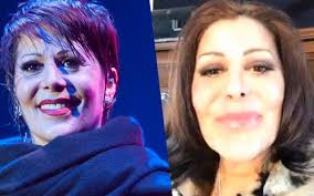 .alejandra guzmán fue sometida ayer a una cirugía para retirarle la sustancia que un doctor le pero lo más sorprendente, según enrique guzmán, padre de la cantante, fue que en el organismo de. Que Le Paso A Tu Rostro Le Preguntan A Alejandra Guzman Sus Seguidores Critican Sus Cirugias Y Hasta Con El Psicologo La Quieren Mandar Libertad Bajo Palabra
