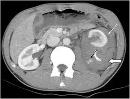Image result for Genitourinary Trauma