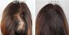 Olive Oil For Hair Before And After Men