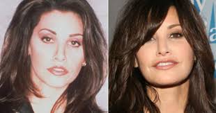 Chatter Busy Gina Gershon Plastic Surgery Plastic Surgery Celebrity Plastic Surgery Gina Gershon