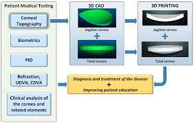 Symmetry Free Full Text 3d Printed Personalized Corneal Models As A Tool For Improving Patient S Knowledge Of An Asymmetric Disease Html
