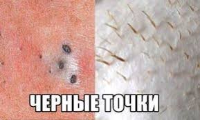 маска для лица из желатина и молока от черных точек Predlagayu Vashemu Vnimaniyu Prostoj I Ochen Deshevyj Metod Udaleniya Sebuma Gryazi I Prochih Byak Iz Por V G Chernye Tochki Udalenie Chernil Zhelatinovaya Maska Dlya Lica