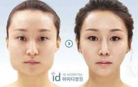 31 Crazy Before And After Photos Of Korean Plastic Surgery Korean Plastic Surgery Plastic Surgery Pictures South Korean Plastic Surgery