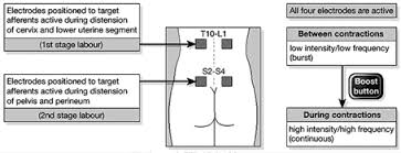 Pin On Health Tens Machine