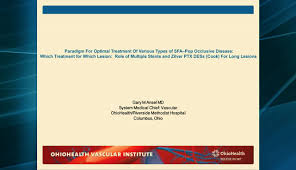 Paradigm For Optimal Treatment Of Various Types Of Sfa Pop