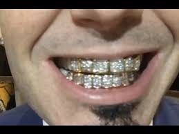 How much does tooth diamond cost in los angeles? Paul Wall Flexing Diamond Grill Worth 90k At Grammys Youtube
