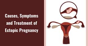 An ectopic pregnancy occurs when the fertilized egg attaches itself in a place other than inside the uterus. Ectopic Pregnancy Healofy