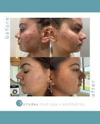 Hollyday Med Spa + Aesthetics