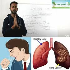 Still other symptoms involve metabolic. Understanding Lung Carcinoma Lung Cancer Symptoms Causes Diet Lifestyle And Prevention By Planet Ayurveda