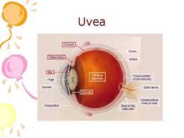 Check spelling or type a new query. Anatomy And Diseases Of The Uvea Anatomy Uvea