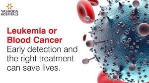 World blood pressure rises (2016). Early Symptoms Of Leukemia Leukemia Or Blood Cancer Early Detection And The Right Treatment Can Save Lives