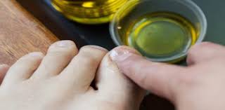 2 Remedios Caseiros Para Voce Eliminar Definitivamente Fungos Nas Unhas Com Imagens Fungos Nas Unhas Fungos Tratamento De Unhas