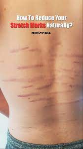 Pin On Mens Health