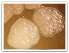 Même pas besoin de calculer le temps de décongélation ou de cuisson. Botulisme Sante Publique Sante Et Des Soins Aux Personnes Agees Province Du Manitoba