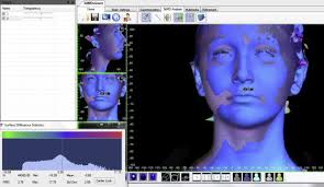 Evaluation of soft-tissue changes in young adults treated with the Forsus  fatigue-resistant device