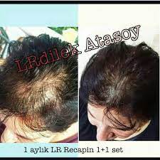 Lrturkey L Recapin Sac Dokulmesi Sunglasses Women Beauty Health And Beauty