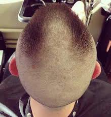 Maybe you would like to learn more about one of these? Barber Guide To The Buzz Cut All Types Of Buzz Cuts With Pictures And Instructions