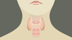When cancer cells do this, it's called metastasis. Thyroid Cancer Metastasis To Bone Survival Rate Low