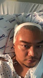 I just won two battles of my life.” The year 2020 was a memorable one for  this 35-year-old man from Manila, who found out he has brain tumor days  after testing positive