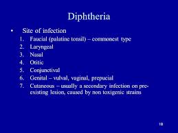 Diphtheria is a vaccine preventable disease with characteristic features of fever, sore throat, pseudo membrane and… Corynebacteria Ppt Video Online Download