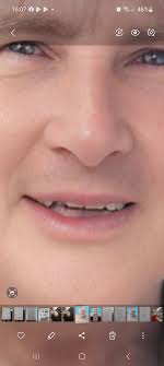 Can a photo's lip features be enhanced?