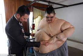 The first phase which began in 1635 and ended with the 1648 peace of westphalia is considered a related conflict of the thirty years' war. The World S Former Fattest Man At 93st Has Life Saving Surgery Daily Mail Online