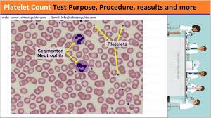 Image result for Platelet Count