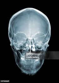 Image result for Skull XRay