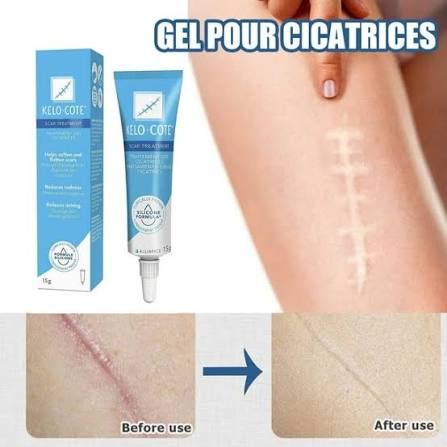 Kelo-Cote Gel For Scars 6G By Kelo-Cote Scar Gel New And Old Hypertrophic Keloids Caused By General Trauma Burns Etc. Silicone Gel (15G) Gel 15Gx1 - Walmart.ca