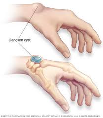Pin On Health