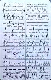 Ecg Highlights Features Of Common Rhythm Strips