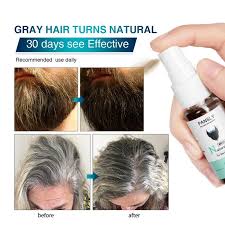 Buy Pansly Beard Hair Restore To Natural Hair Color Spray For Unisex Herbal Cure At Affordable Prices Price 5 Usd Free Shipping Real Reviews With Photos Joom