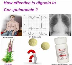 Image result for Cor Pulmonale