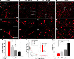 Whether the food is baked, fried, sautéed, bo. Ab Receptors Specifically Recognize Molecular Features Displayed By Fibril Ends And Neurotoxic Oligomers Nature Communications