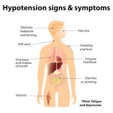 Low Blood Pressure Treatment Symptoms Signs Causes Diet