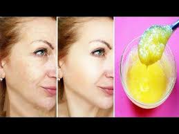 How To Get Rid Of Wrinkles In 7 Days Using A Botox Mask To Remove Wrinkles And Look Younger Youtube In 2020 Wrinkle Remover Botox Wrinkles