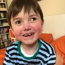 Unheilbare Krankheit: Wie ein krankes Kind das Leben verändert