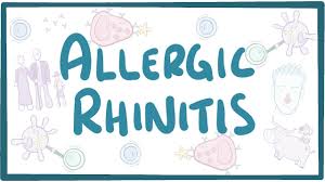 Image result for Allergic Rhinitis