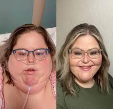 Does 3 AP make alot of difference between normal lss and lss ce in terms of  damage ouput and which would you go for considering the price?