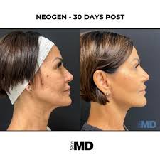 TOP 10 BEST Mole Removal near Franklin, MA