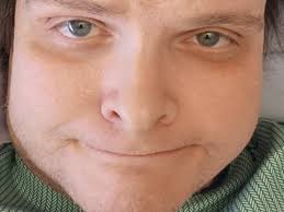 Fundraiser by Jamie Daley : Back in hospital couple months, will need 5th  surgery.