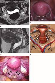 Many pelvic landmarks, ligaments, and muscular structures within the pelvis are important to know to differentiate normal reproductive organs from muscular and vascular structures. Normal Anatomy Of The Female Pelvis A B Axial A And Sagittal B Download Scientific Diagram