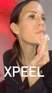 Progress content is my favorite content ⬇️🧪💉, (Today is even better,  watch