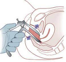Check spelling or type a new query. Panoramic Extraoral Radiographic Examination Definition Of Panoramic Extraoral Radiographic Examination By Medical Dictionary