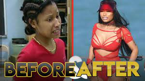 Recently, the music world received some news that didn't come quite as a shock but apparently it has made the ticker tape regardless. Nicki Minaj Before After Transformation Plastic Surgery Makeup More Youtube