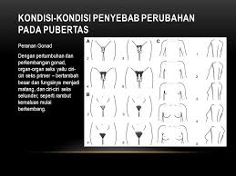 Apakah ciri pubertas pada perempuan sudah mulai muncul pada diri roro ya? Masa Puber Dan Masa Remaja Ppt Download