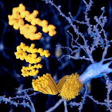 Amyloid structure linked to different types of Alzheimer's disease |  National Institute on Aging